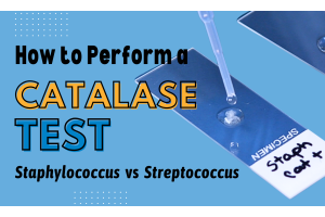 How to perform a catalase test to differentiate Staphylococcus from Streptococcus