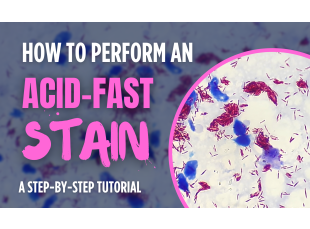 How to perform an Acid-Fast Stain