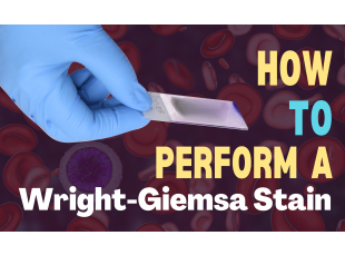 How to do a Wright-Giemsa Stain