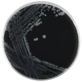 Buffered Charcoal Yeast Extract (BCYE) Selective Agar with Cycloheximide, Colistin, Vancomycin, and Cephalothin (CCVC)