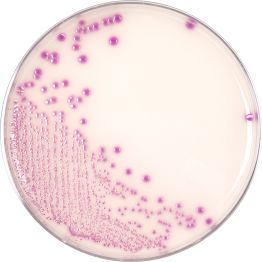 HardyCHROM™  O157 (E. coli O157), Chromogenic Medium