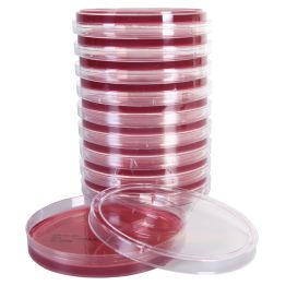 SS (Salmonella Shigella) Agar