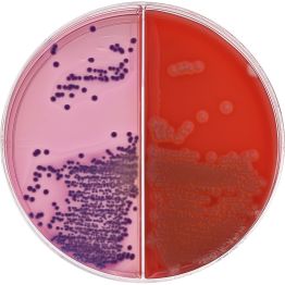 HardyCHROM™ BluEcoli™ Urine Biplate (5% Blood Agar/BluEcoli), Chromogenic BiPlate