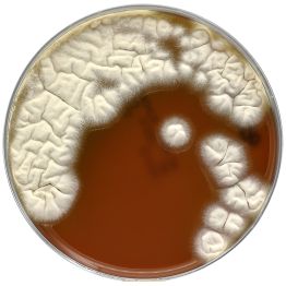 BHI Agar Plate with Blood, Chloramphenicol and Gentamicin