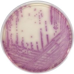 HardyCHROM™  Salmonella, Chromogenic Medium