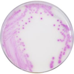 HardyCHROM™ CRE (Carbapenem-Resistant Enterobacterales), Chromogenic Medium, 100mm Plate