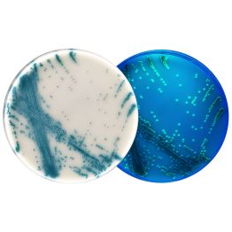 Candida auris plates under normal and UV lighting with teal to teal-green colonies.
