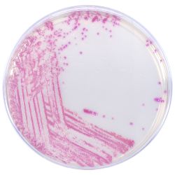 HardyCHROM™ MRSA, (methicillin-resistant Staphylococcus aureus), Chromogenic, Reduced Stacking Ring (RSR),100mm Plate