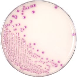 HardyCHROM™ O157 (E. coli O157), Chromogenic Medium