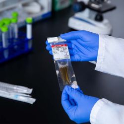 TV LIVE Culture, Detects Trichnomonas vaginalis