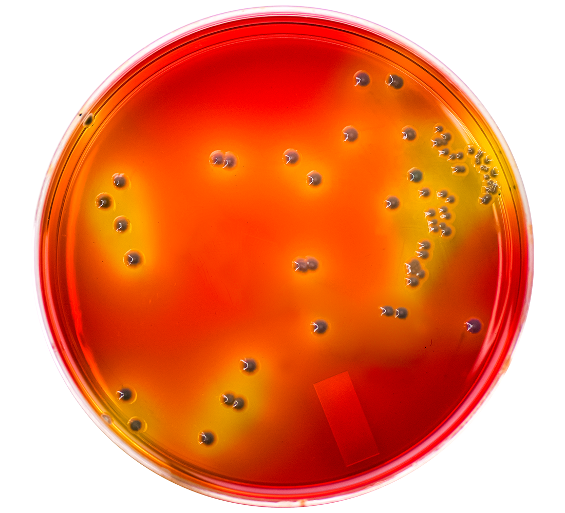 Burkholderia cepacia Selective Agar (BCSA), USP