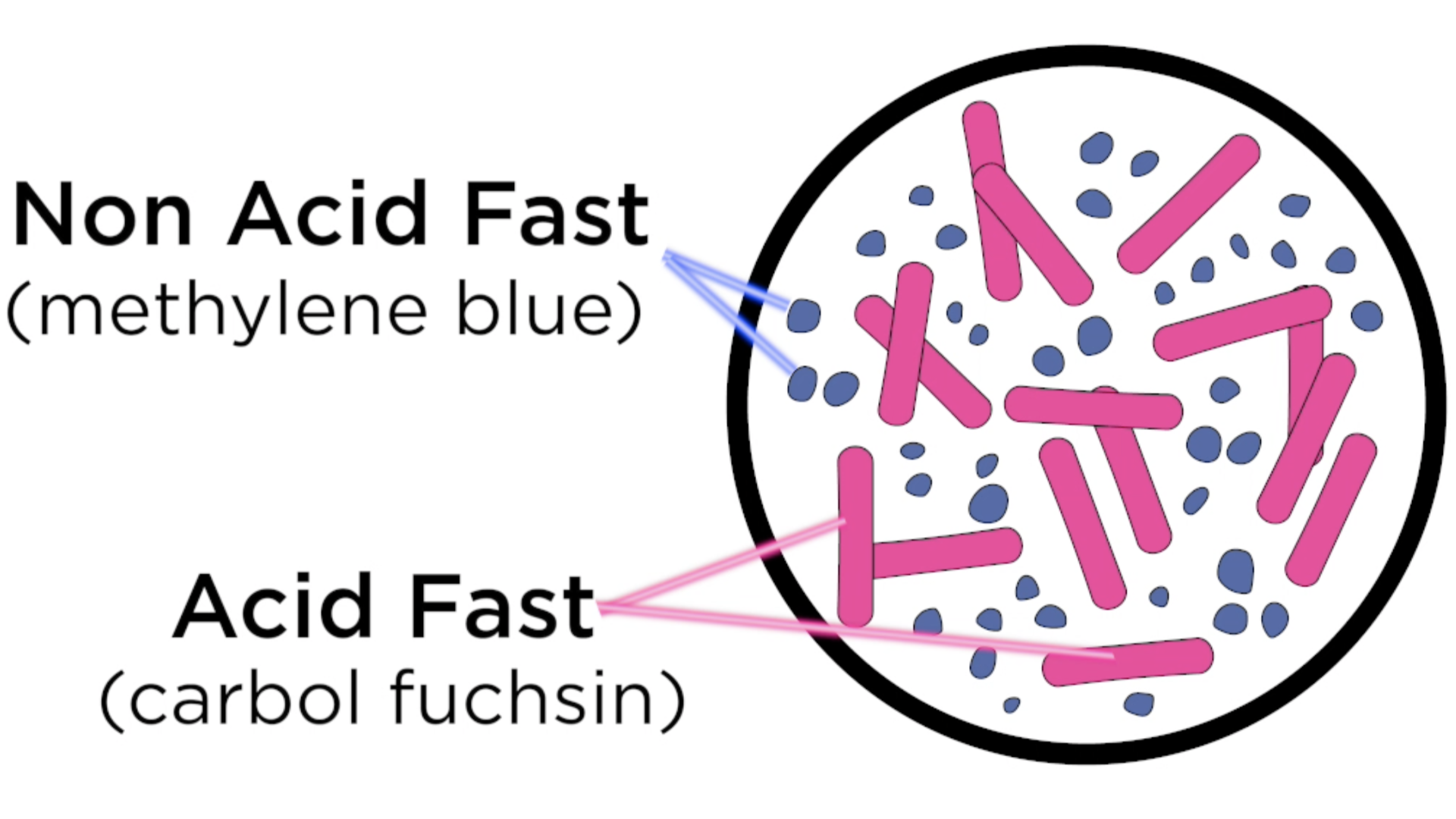 non_acid_acid_fast_stain_infographic_blue_dots_
