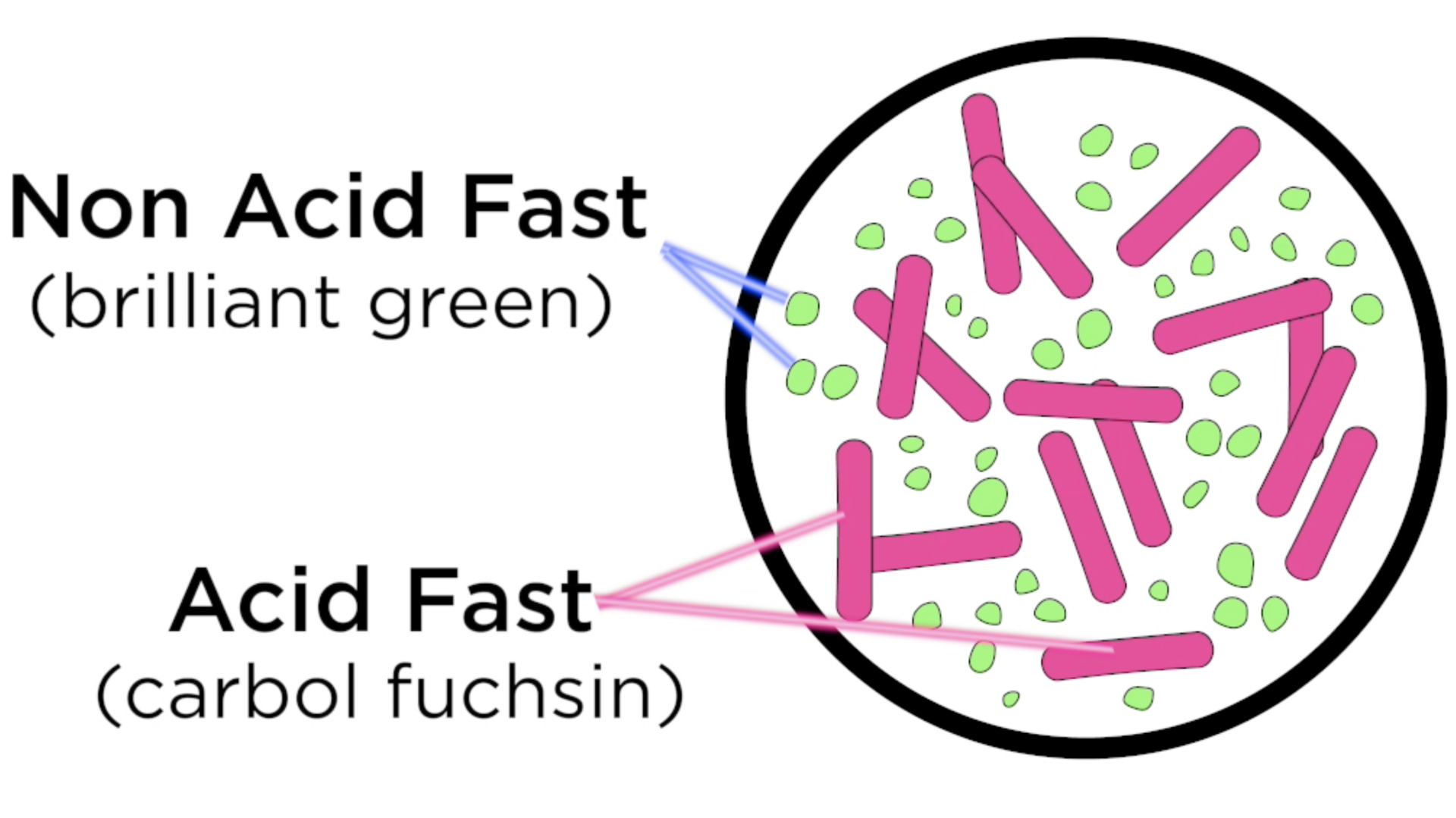 non_acid_acid_fast_stain_infographic_green_dots_