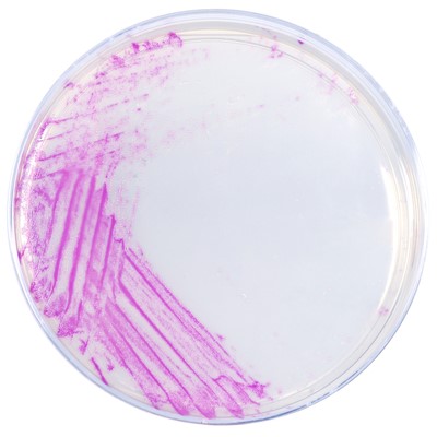 G311_HardyCHROM_Staphylococcus_Aureus