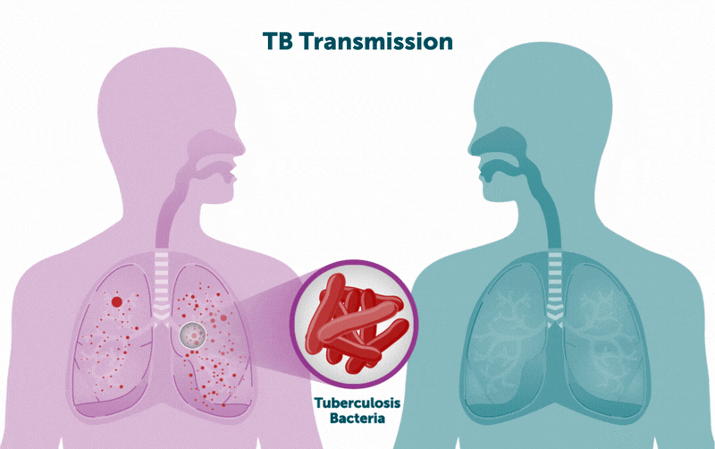 TB_Transmission_GIF