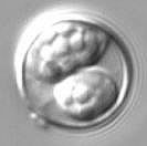 cylospora_-_oocyst_with_2_developing_sporocysts