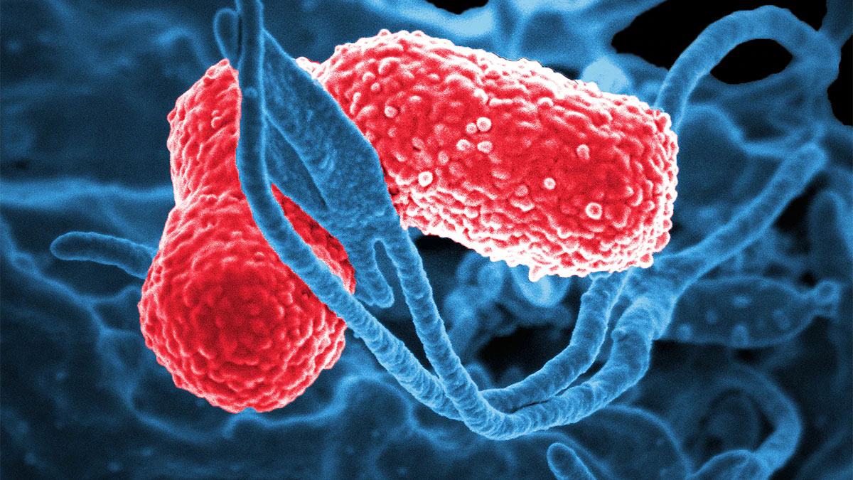 klebsiella